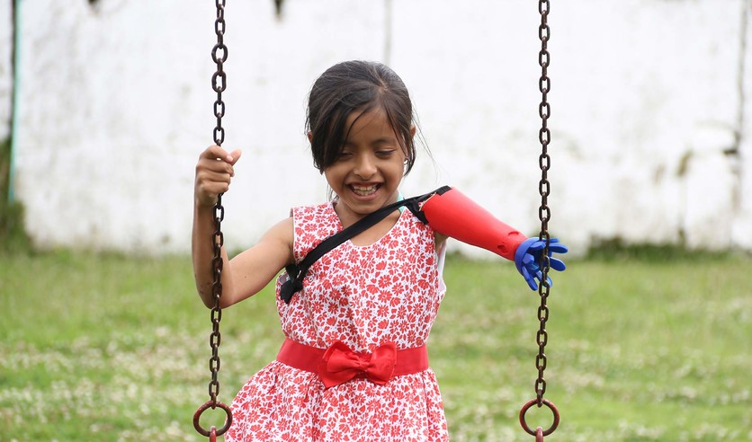 little girl with prosthetic on a swing